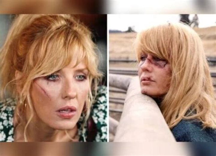 Did Yellowstone Stars Opt For Cosmetic Enhancements? Uncover The Truth